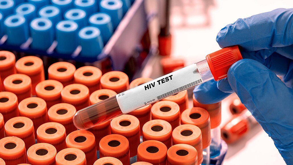 HIV v Česku dál přibývá. Případy nejsou jen ve velkých městech, týkají se i Jihočeského kraje