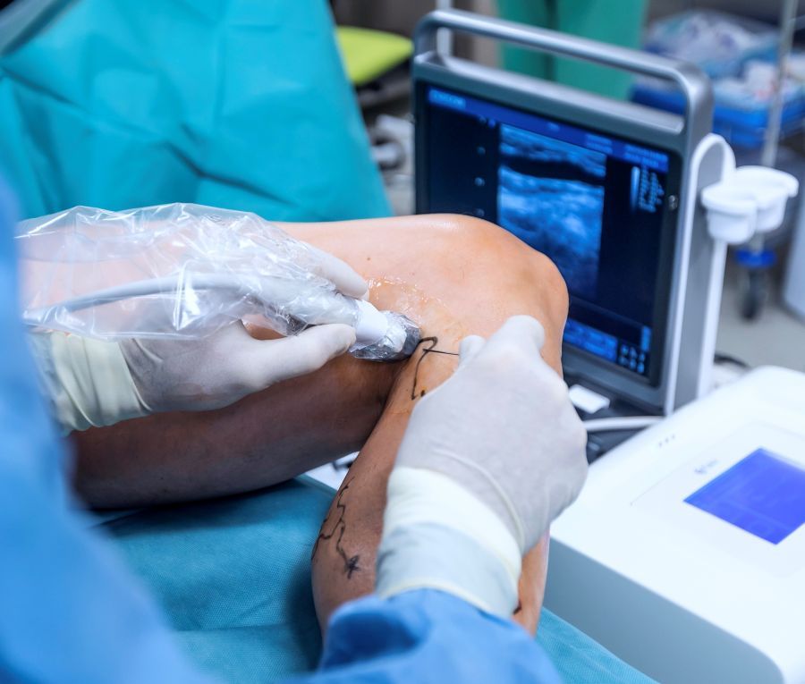 Nemocnice Písek rozšiřuje šetrné operace žil, hemoroidů i kýl: méně bolesti a rychlejší návrat domů